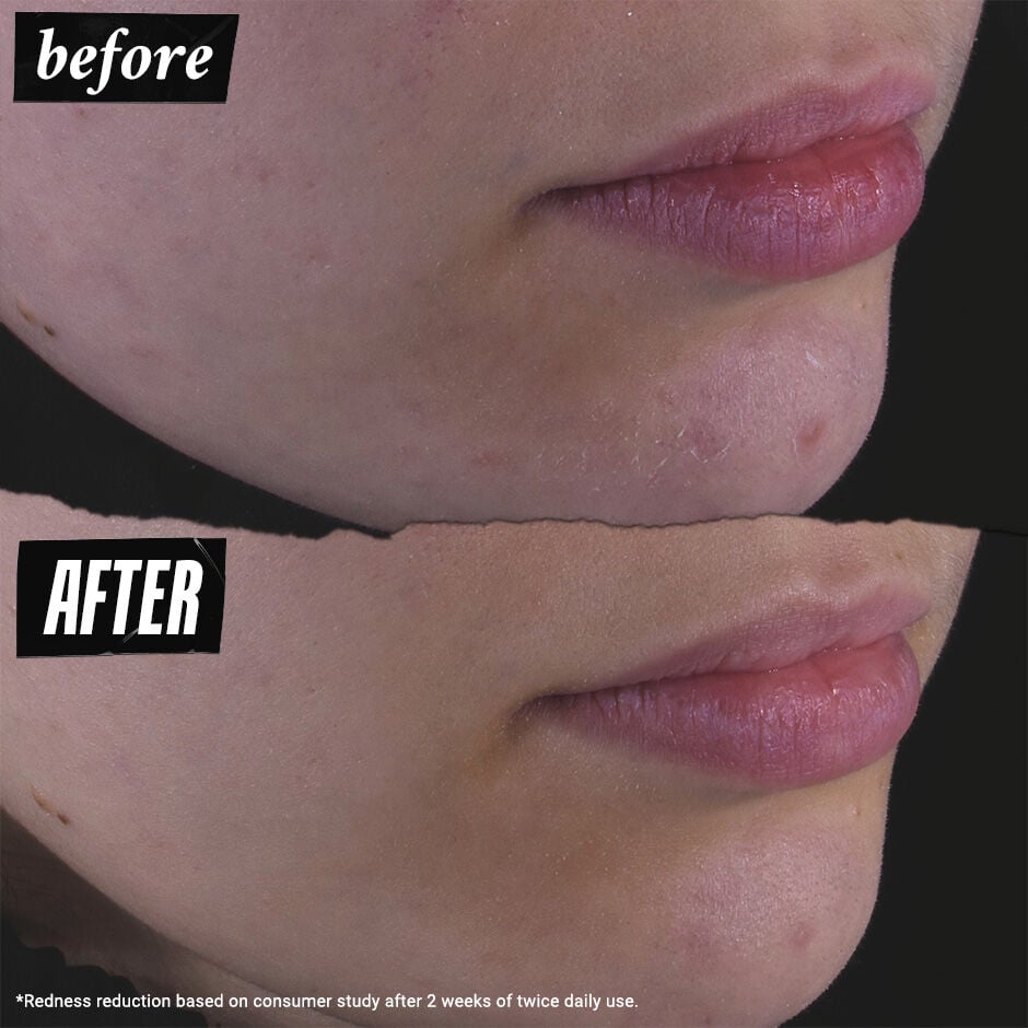 Kiehl's Clearly Corrective™ Dark Spot Solution - 0.5 oz