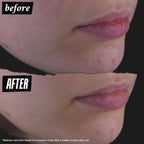 Kiehl's Clearly Corrective™ Dark Spot Solution - 0.5 oz