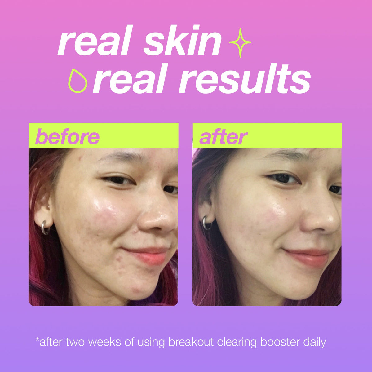 Dermalogica Clear Start Breakout Clearing Booster 1oz