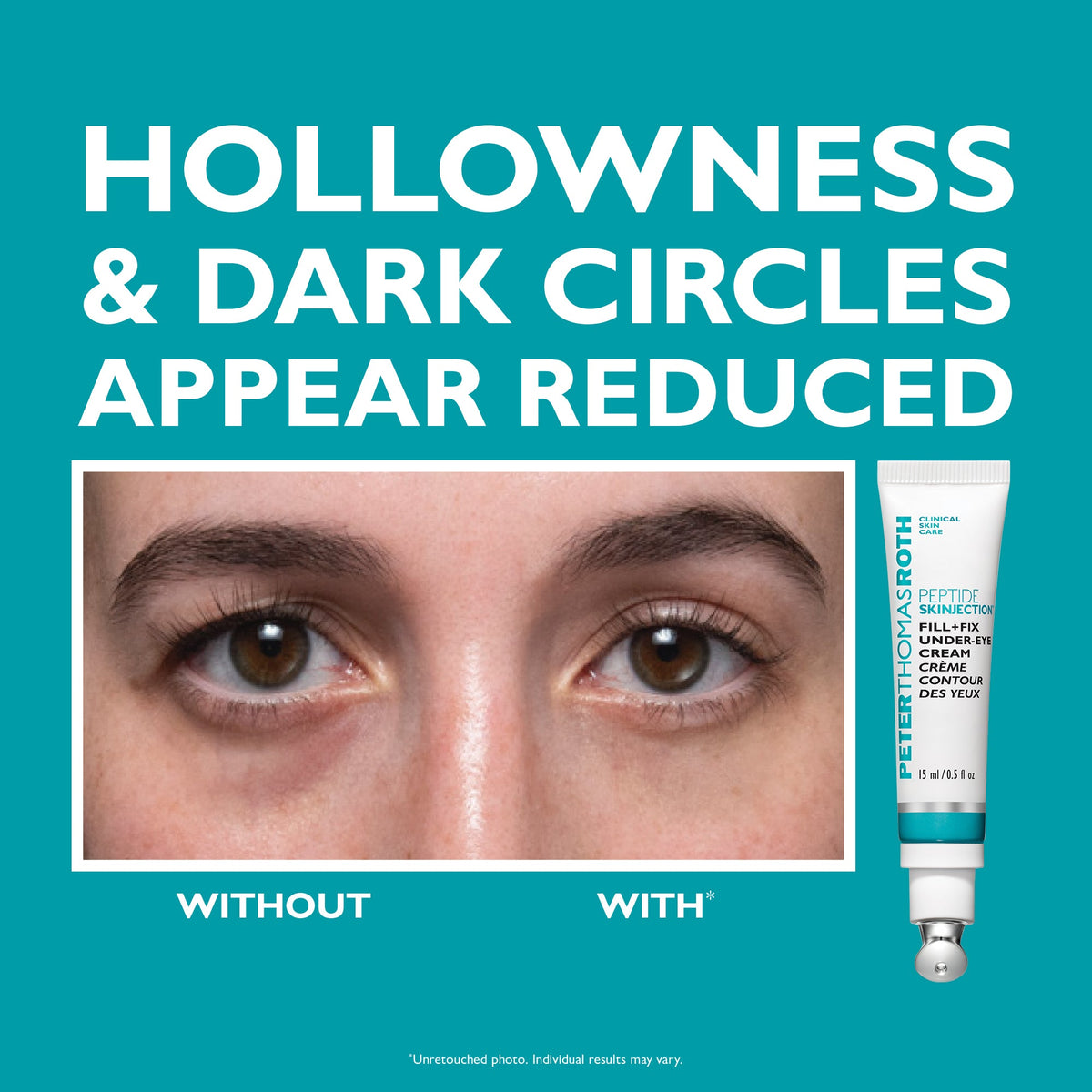 Peter Thomas Roth Peptide Skinjection Peptide Infused Face + Eye Tape