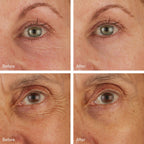 Skyn Iceland Hydro Cool Firming Eye Gels 8-Pack