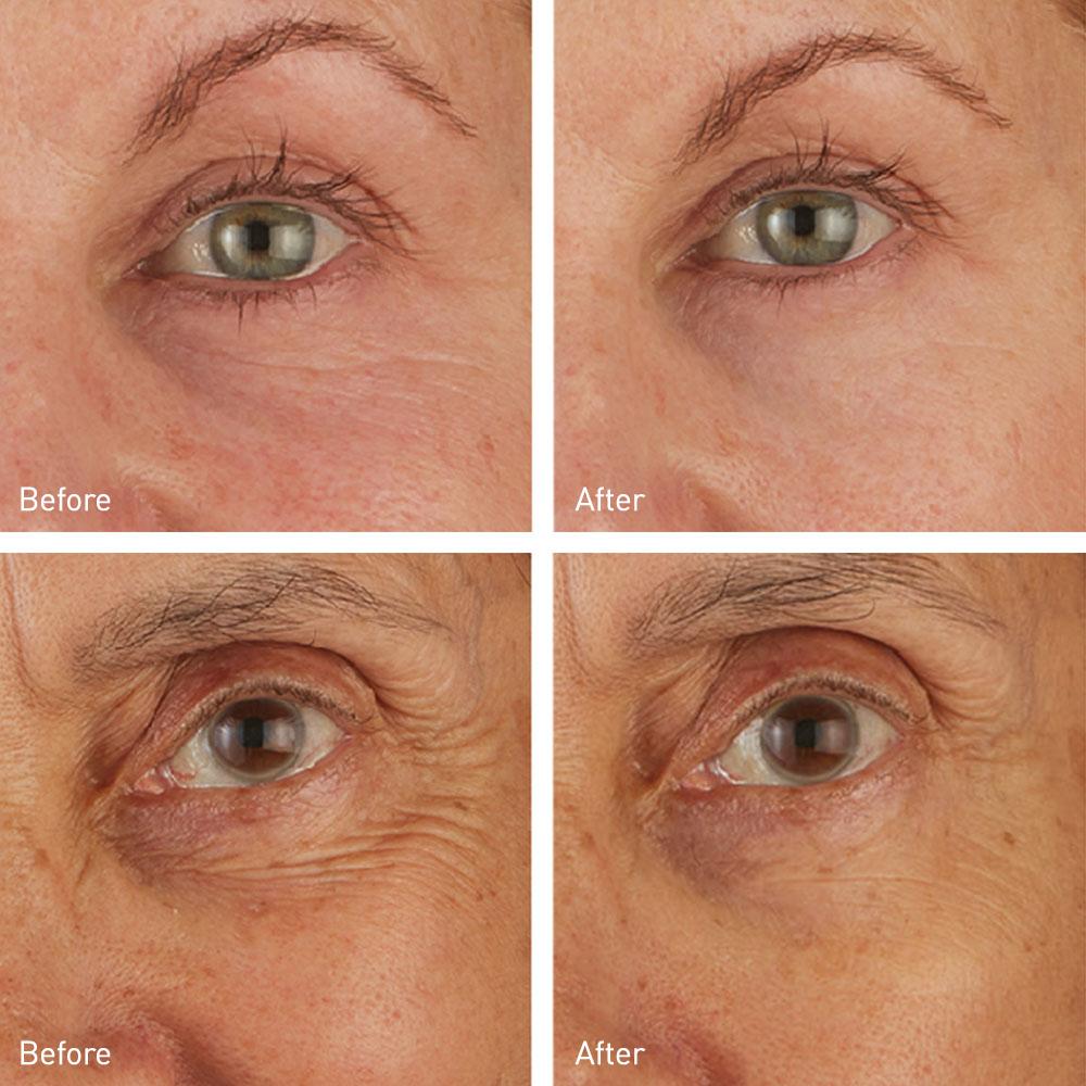 Skyn Iceland Hydro Cool Firming Eye Gels 8-Pack