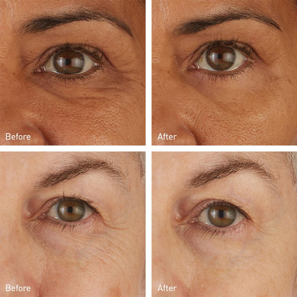 Skyn Iceland Hydro Cool Firming Eye Gels 8-Pack