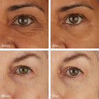 Skyn Iceland Hydro Cool Firming Eye Gels 8-Pack