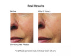 Murad Resurgence Rapid Collagen Infusion