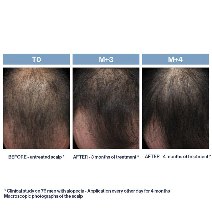 Phytolium+ Initial Stages Strengthening Treatment 3.38oz