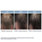 Phytolium+ Initial Stages Strengthening Treatment 3.38oz