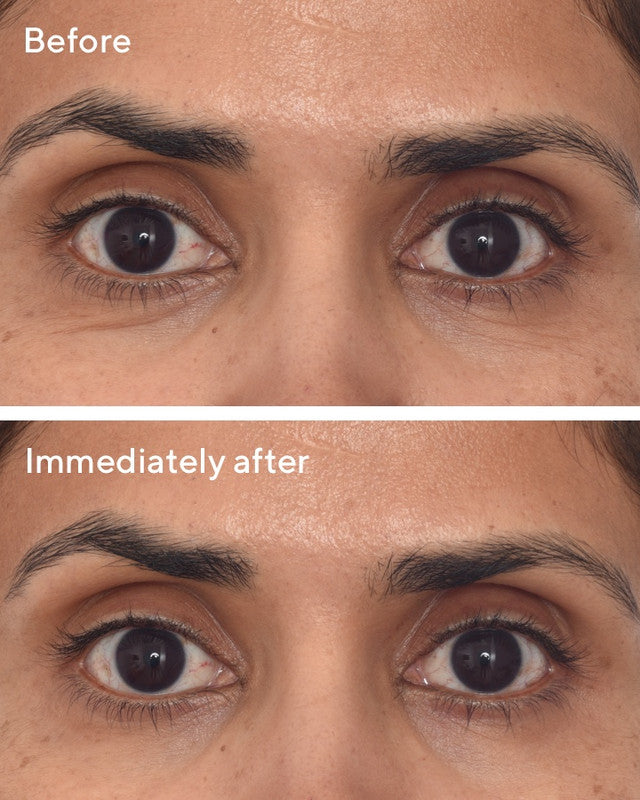Murad Dr. Zion x Murad Retinol Youth Renewal Eye Masks - Single Pack