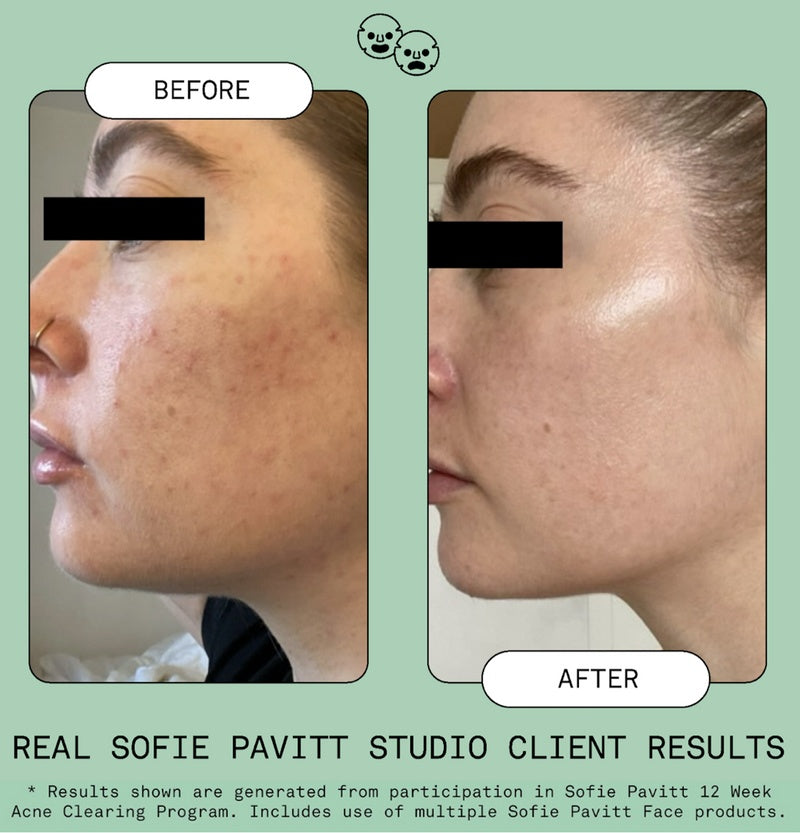 SOFIE PAVITT FACE Nice Ice Toner Pods - 12 Pods