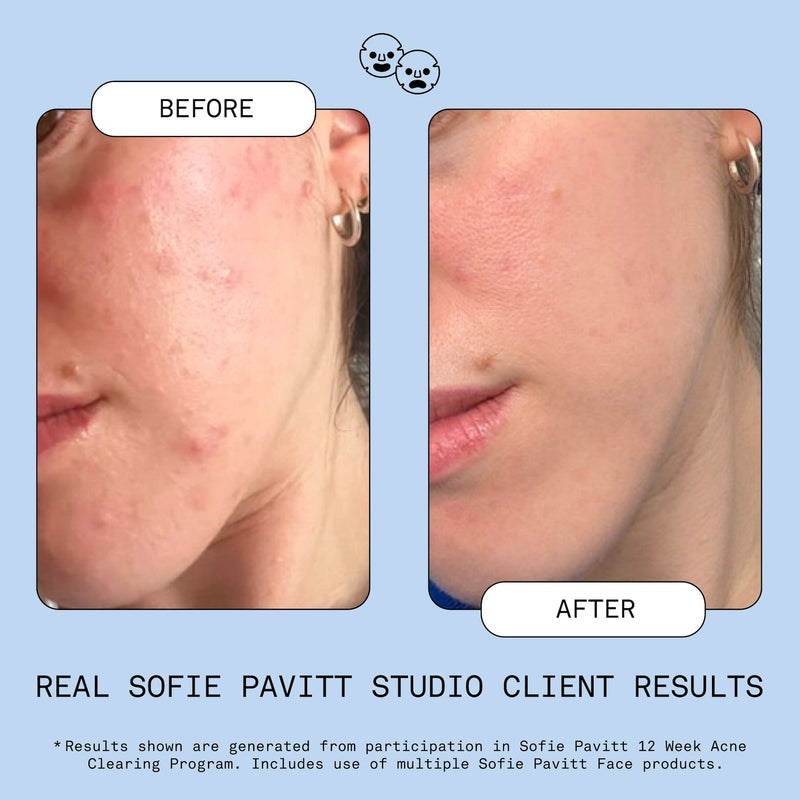 SOFIE PAVITT FACE Fridge to Face Blemish Defense Mist 3.2oz