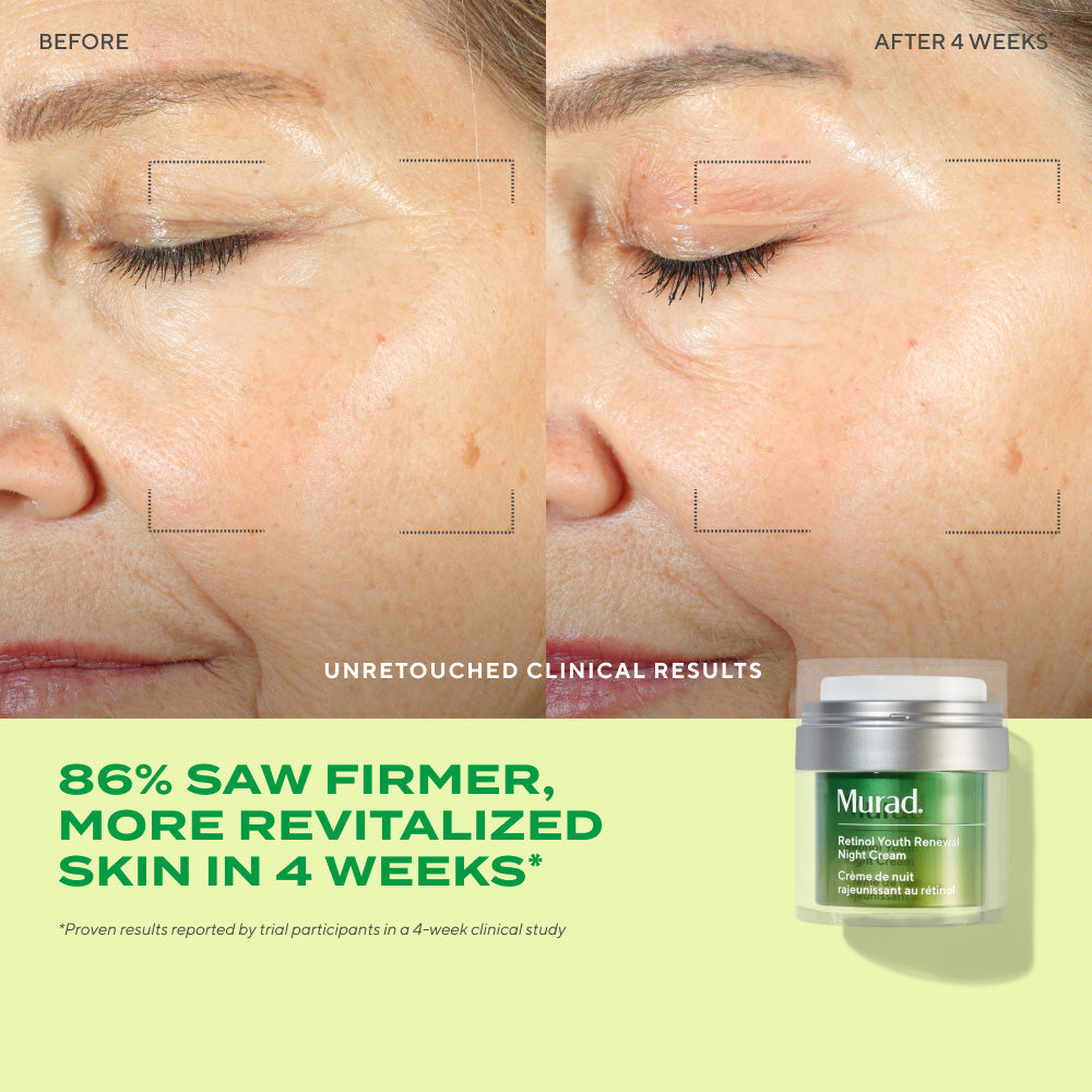 Murad Resurgence Retinol Youth Renewal Night Cream