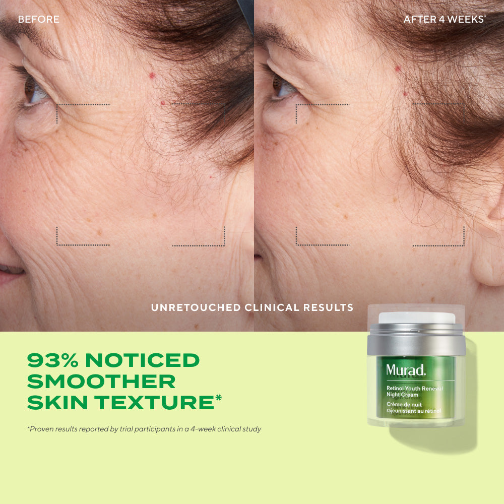 Murad Resurgence Retinol Youth Renewal Night Cream