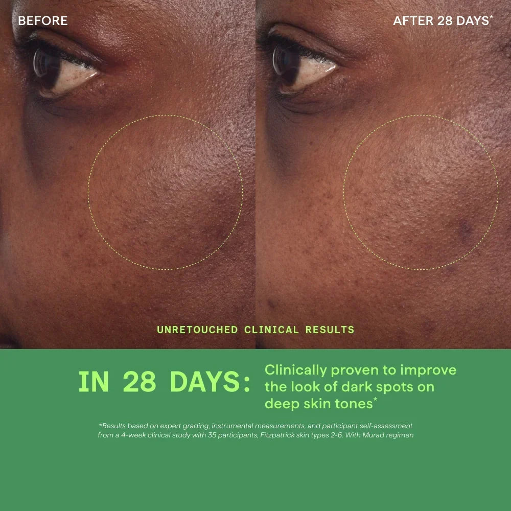 Murad Rapid Dark Spot Correcting Serum