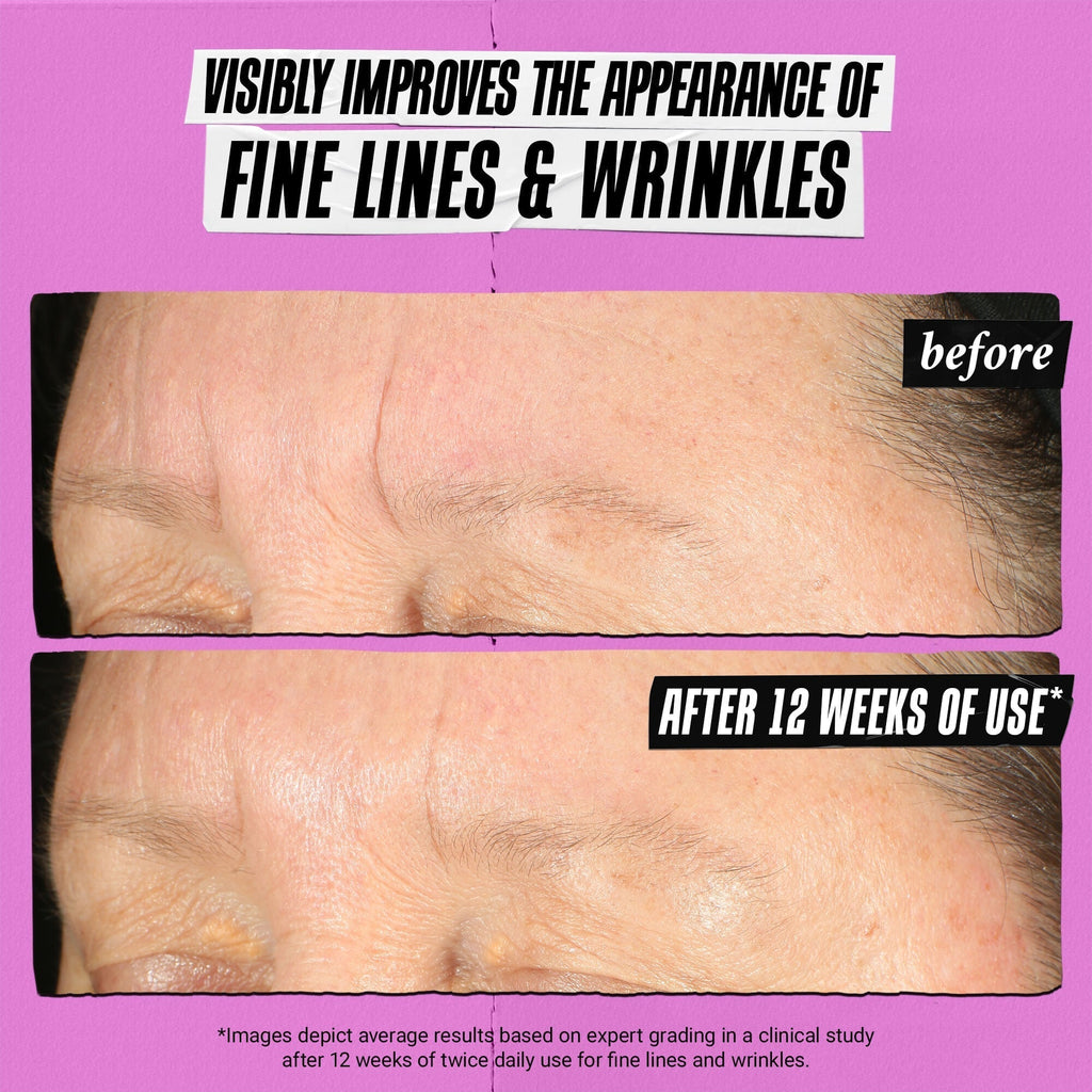 Kiehl's Powerful-Strength Line-Reducing Concentrate 3.4oz