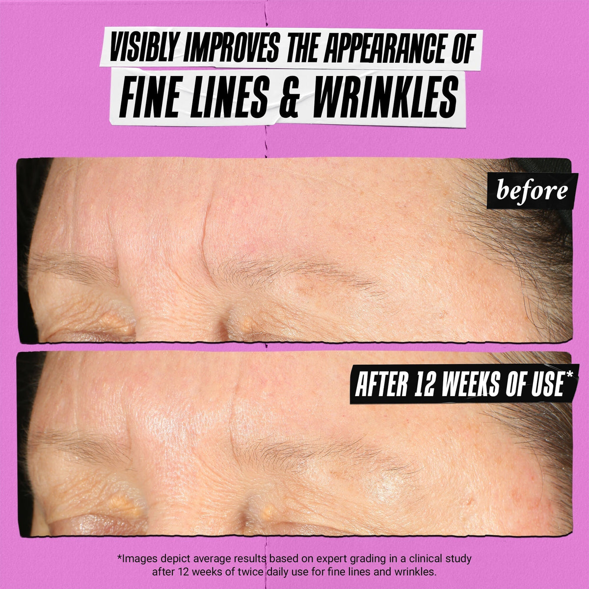 Kiehl's Powerful-Strength Line-Reducing Concentrate 3.4oz