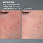 Dermalogica Daily Microfoliant 0.45oz