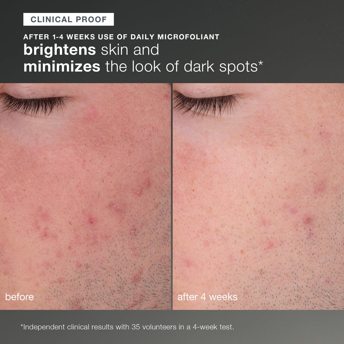 Dermalogica Discover Healthy Skin Kit