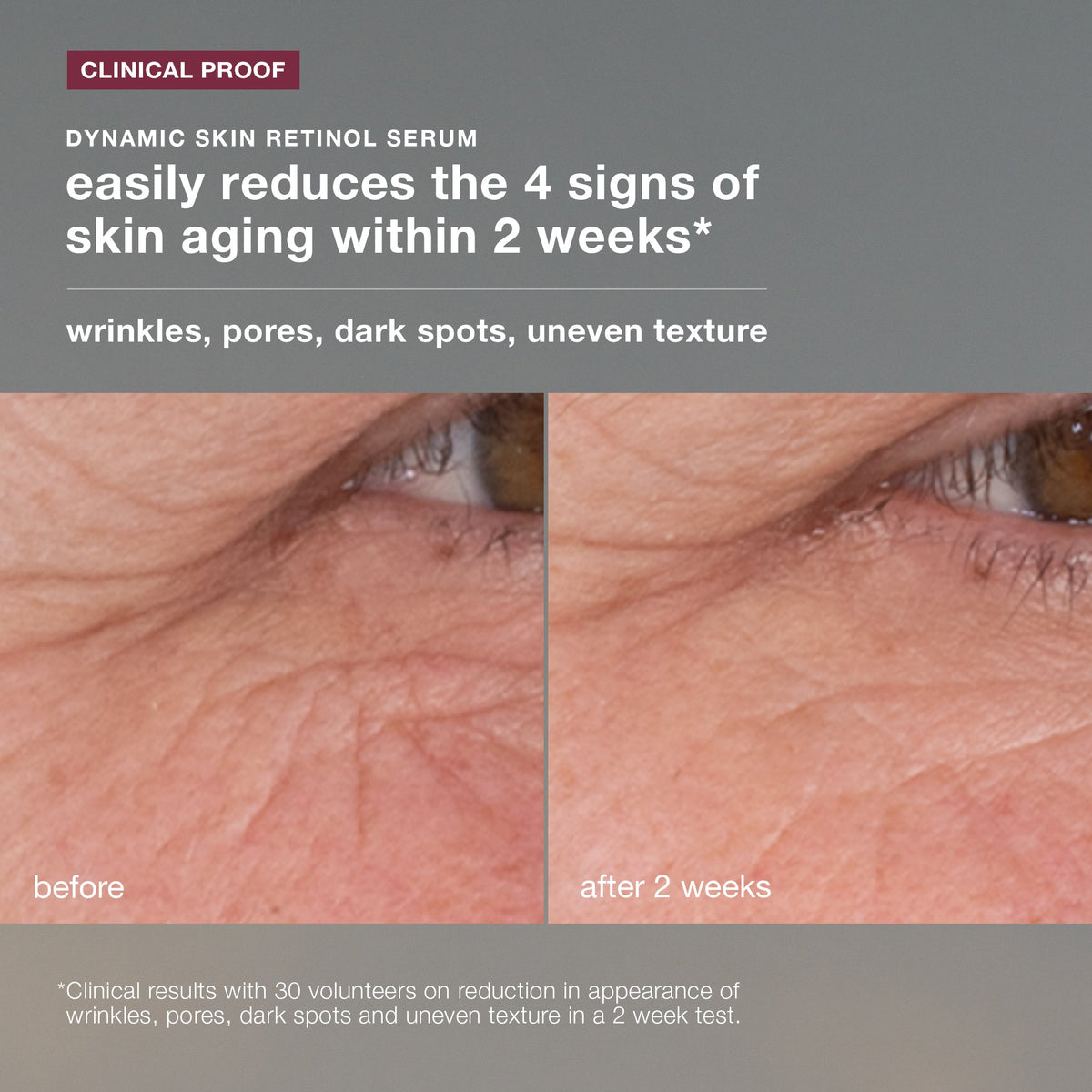 Dermalogica AM Radiance + PM Renewal Kit