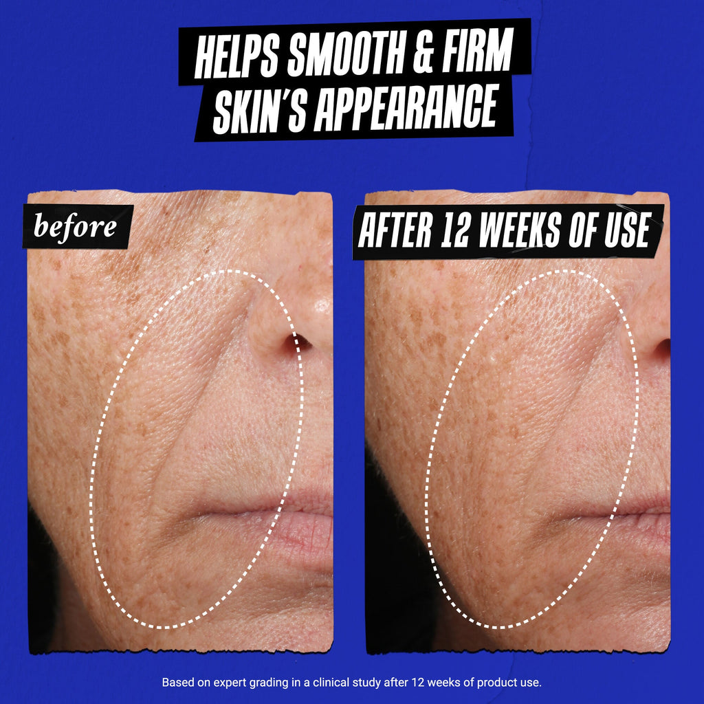 Kiehl's Powerful-Strength Line-Reducing Concentrate 3.4oz