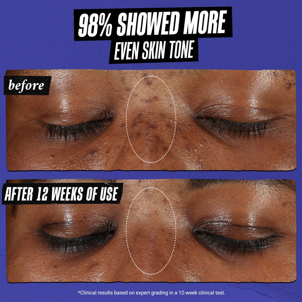 Kiehl's Clearly Corrective™ Dark Spot Solution - 0.5 oz
