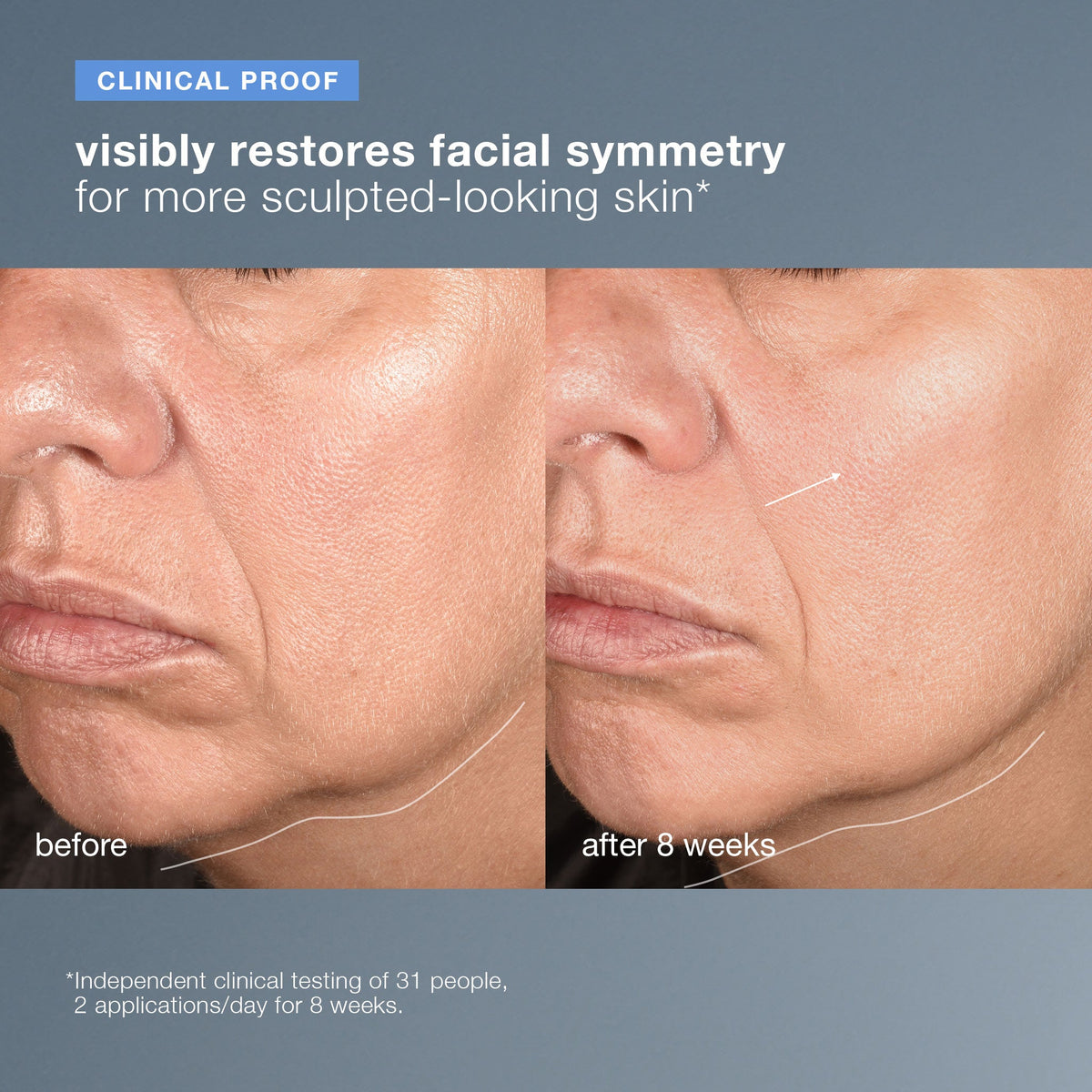Dermalogica Neurotouch Symmetry Serum 1oz