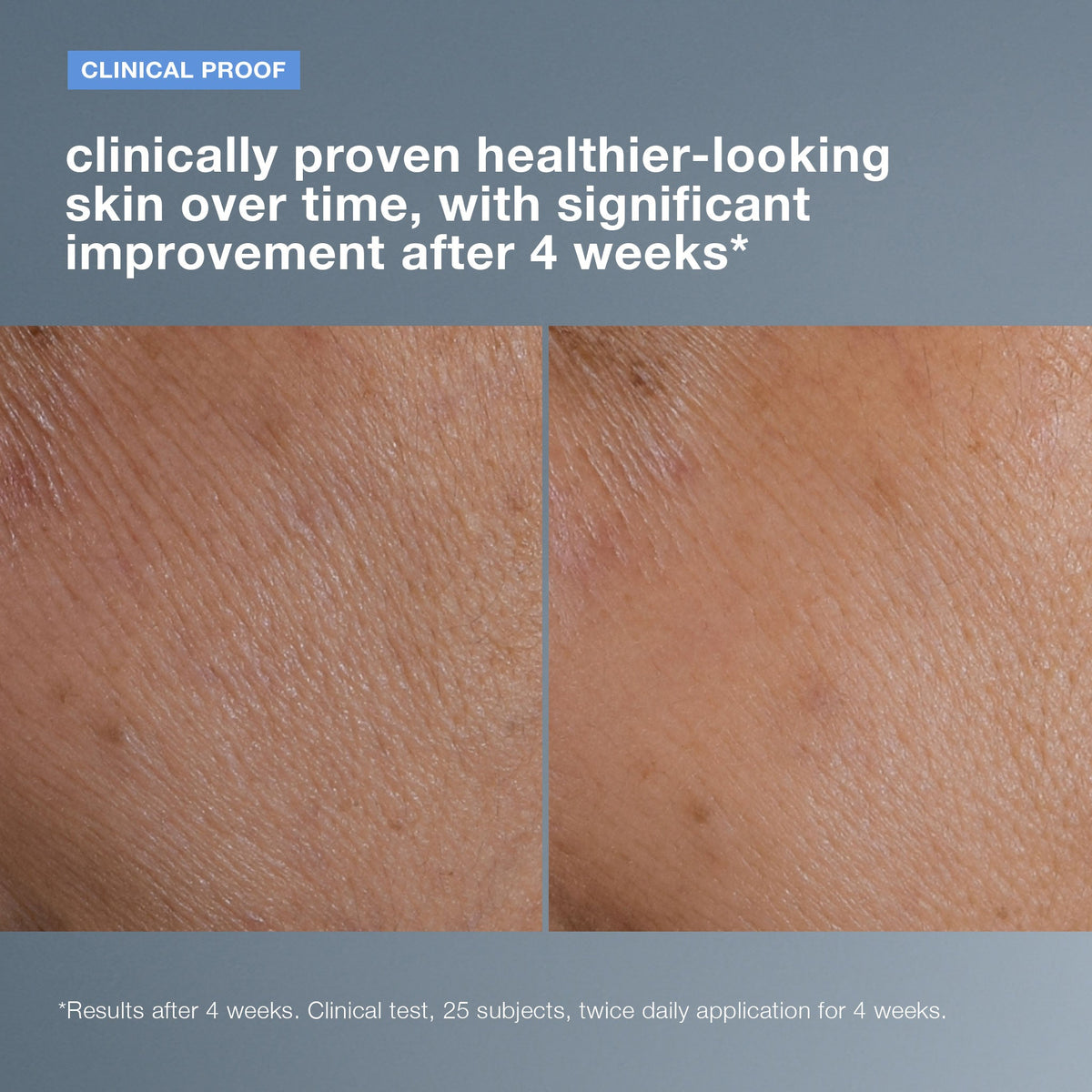 Dermalogica Smart Response Serum 1oz