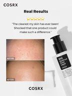 COSRX BHA Blackhead Power Liquid 3.3oz