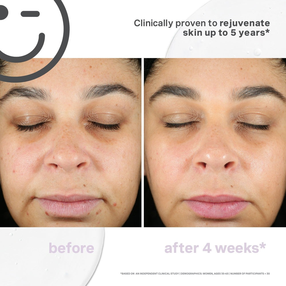 Kate Somerville KateCeuticals SuperCell Rejuvenation Serum 1oz