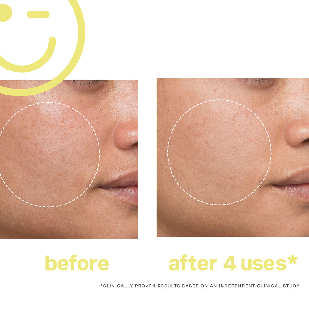 Kate Somerville Mega-C 30% Vitamin C Brightening Facial 2oz