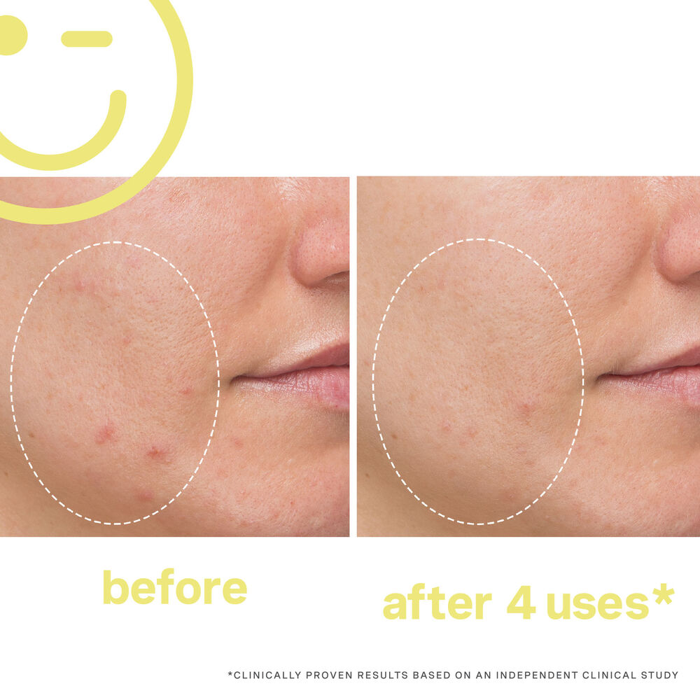 Kate Somerville Mega-C 30% Vitamin C Brightening Facial 2oz