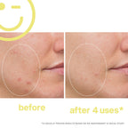 Kate Somerville Mega-C 30% Vitamin C Brightening Facial 2oz