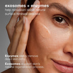 Dermalogica Phyto Nature E2 Regenerating Daily Exosome Leave-On Treatment 3.4oz