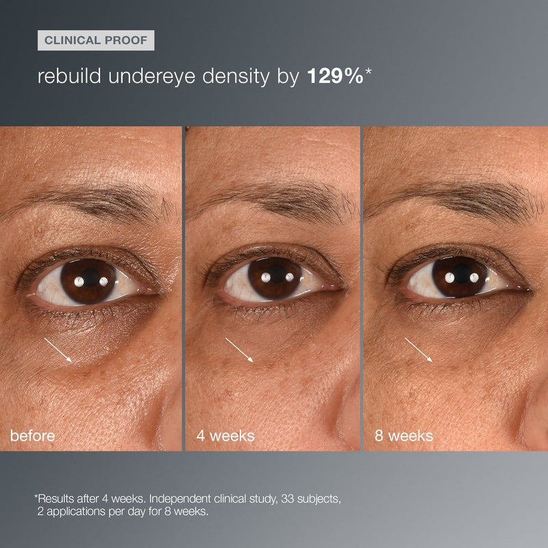 Dermalogica Smart Eye Density Undereye Serum 0.5oz