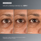 Dermalogica Smart Eye Density Undereye Serum 0.5oz