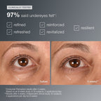 Dermalogica Smart Eye Density Undereye Serum 0.5oz