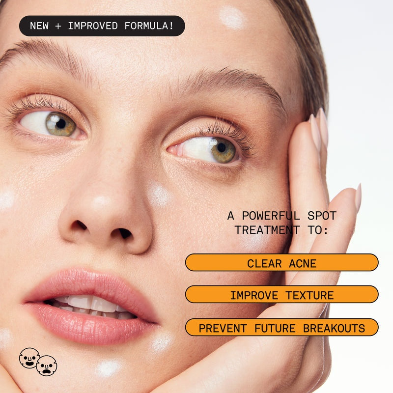 SOFIE PAVITT FACE Reset 5% Benzoyl Peroxide Acne Treatment 1oz