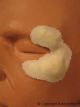 FRW-028 Swollen Cheek Left 114721  